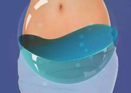赣州供卵助孕包成功：在体外移植成功后，盆腔积液可能会恶化，请注意以下几点，以帮助缓解症状。